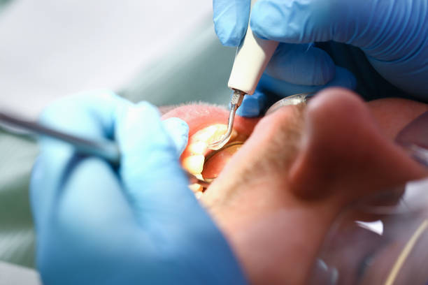 Best Emergency Broken Tooth Repair in Walworth, WI